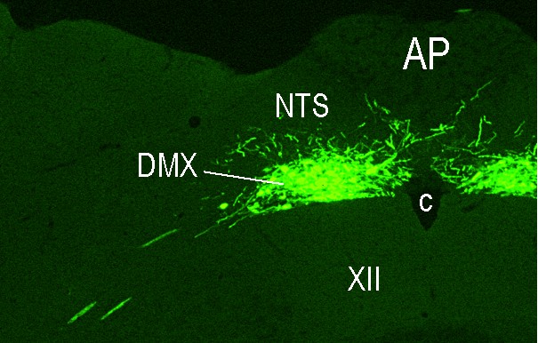 Figure 3: Labeling of the dorsal motor nucleus of the vagus (DMX) after HSV1-H129 injections into the wall of the HPV.